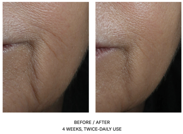 SkinBetter Science InterFuse Intensive Treatment LINES - Image 2